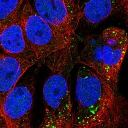 TMEM182 Antibody, Novus Biologicals 0.1mL; Unlabeled:Antibodies, Polyclonal